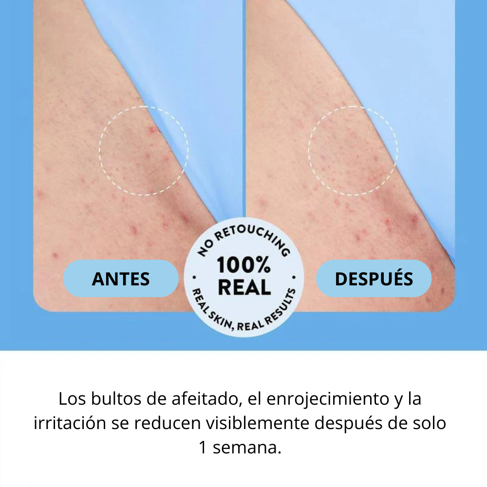 Bellaria - Roll-on Solución Alisadora para Vellos Encarnados
