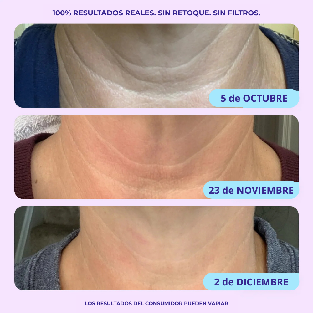 Bellaria - Crema para el cuello goPure